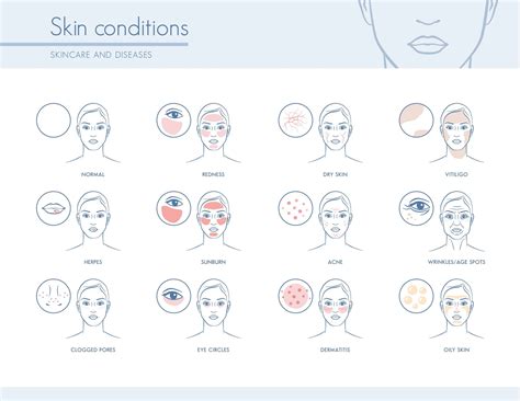 Hormones And Skin Conditions The Complete Guide