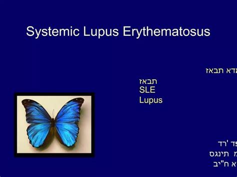 Ppt Systemic Lupus Erythematosus Powerpoint Presentation Free