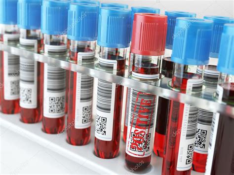 Blood Sample Positive And Many Others Blood Test Tubes In A Rack