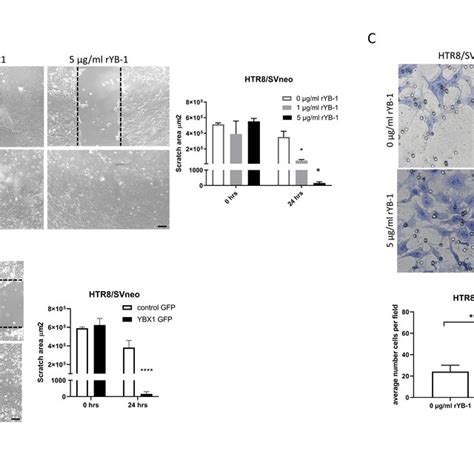 positive effects of yb 1 on migration and invasion in htr8 svneo cells download scientific