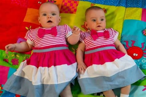 twins born 87 days apart survive set world record the hollywood gossip