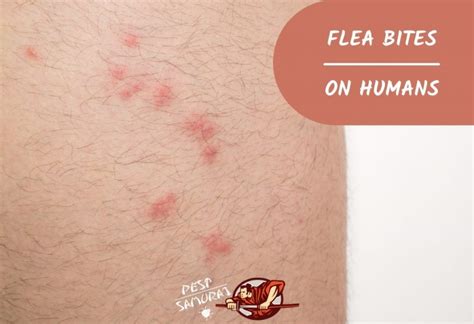 What Do Carpet Flea Bites Look Like Bios Pics