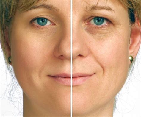 The 5 Minute Face Lift Will Instantly Get Rid Of Fine Lines Wrinkles