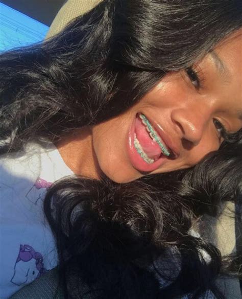 follow my instagram for more pins like this thepageforbaddies ️ braces colors brace face