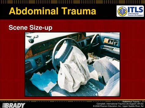 Ppt Chapter 13 Abdominal Trauma Powerpoint Presentation Free