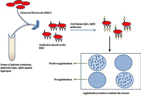 Recent Advances In The Diagnosis Of Leptospirosis
