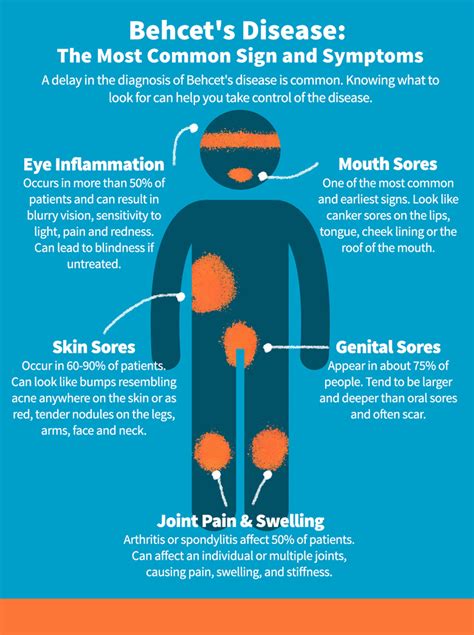 Behçets Disease Symptoms Understanding The Common Signs Celgene