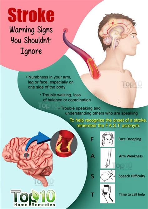 Stroke Warning Signs You Shouldnt Ignore Top 10 Home Remedies