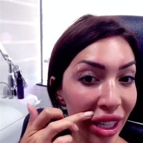 farrah abraham shares video of her lip filler removal who magazine