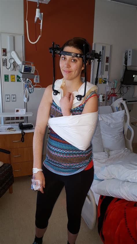 The Halo Diaries Discharged Home After Cervical Spine Fusion