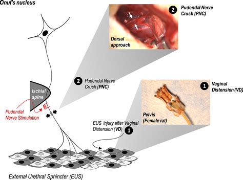 Electrical Stimulation Of The Pudendal Nerve Promotes Neuroregeneration