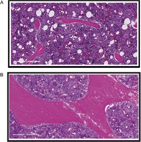 Cancellous Bone Surfaces And Adjacent Marrow In Control A And