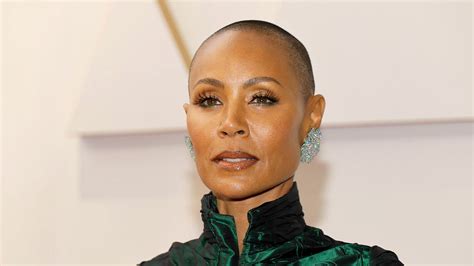 What Is Alopecia Areata The Medical Condition Behind Jada Pinkett