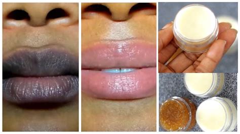 How To Lighten Dark Lips Super Fast 100 Result Youtube Remedies