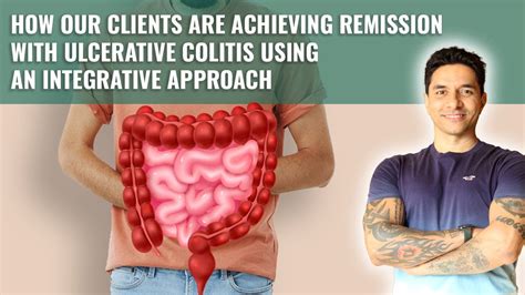 Managing Ulcerative Colitis With Lifestyle Youtube
