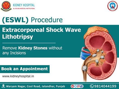 Eswl Procedure Extracorporeal Shock Wave Lithotripsy Eswl Uses