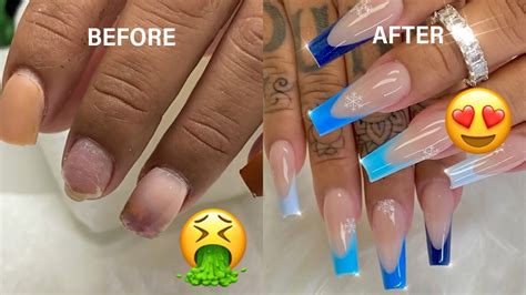 #113 Incredible Nail Transformation Acrylic Nail Art Designs