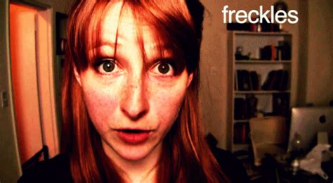 23 Problems Only People With Freckles Will Understand