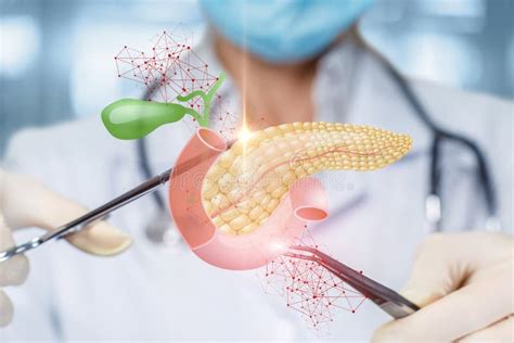 Surgical Treatment Of The Pancreas Stock Image Image Of Illness