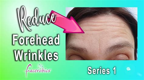 How To Remove Forehead Wrinkles Without Botox Youtube