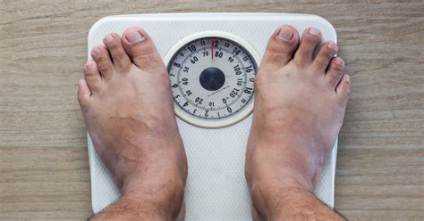 Extreme weight loss brings extreme problems