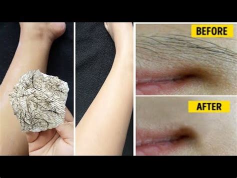 Stop Shaving Here S How To Remove Facial And Body Hair Painlessly