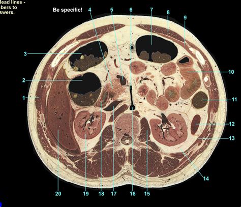 Abdomen 8 Cross Sectional Diagram Quizlet