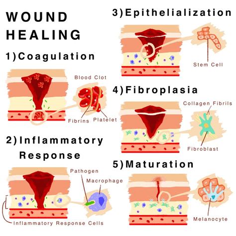 A cutaneous wound five days after injury. Skin Regeneration in Wound Healing: The Art of Self ...