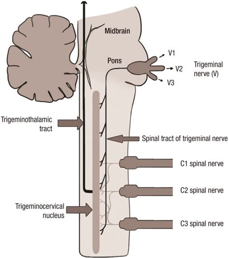Neuralgias Of The Head Occipital Neuralgia Pubmed Artofit