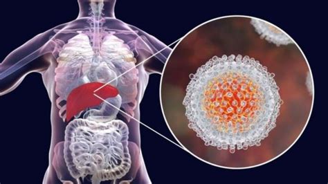 Nobelova Nagrada Za Medicinu Naučnicima Koji Su Otkrili Virus Hepatitis