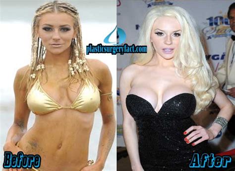 Courtney Stodden Plastic Surgery Before And After Photos