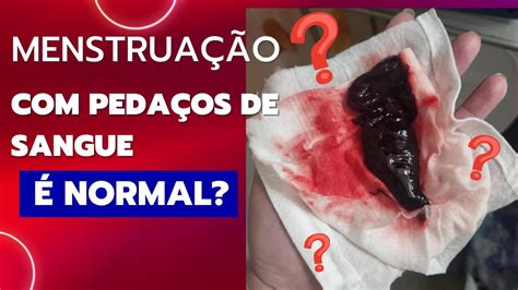 É normal sair um pedaço de carne na menstruação YouTube