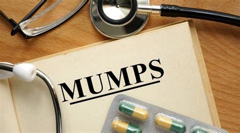 What You Need To Know About The Mumps