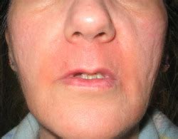 We often blame razor rash on the razor. Dont Use NAIR Hair Remover! - Nair