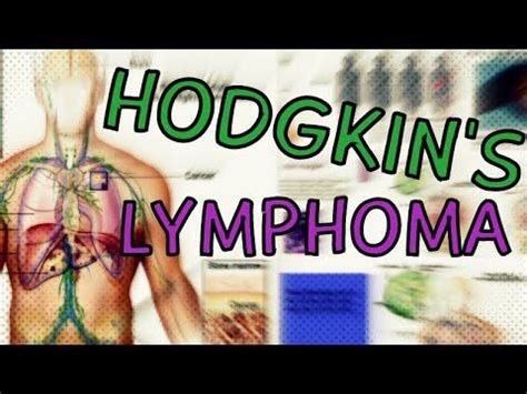 Hodgkin S Lymphoma Types Symptoms Staging Treatment Diagnosis