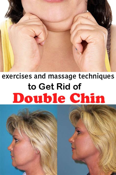 Exercises And Massage Techniques To Get Rid Of Double Chin