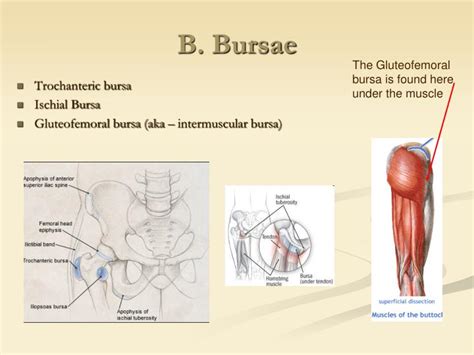 Gluteal Femoral Bursa