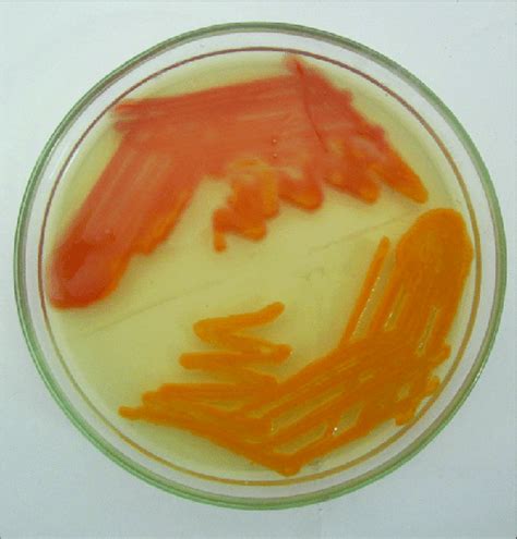 Nutrient Agar Showing Yellow Colonies Turning Red With Addition Of