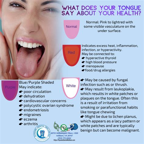 What Does Your Tongue Say About Your Health The Color Of Your Tongue