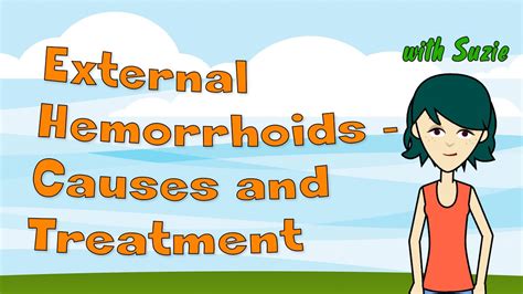 external hemorrhoids causes and treatment youtube