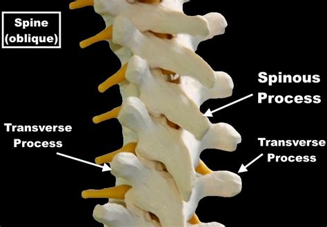 Transverse Process Spine Fracture