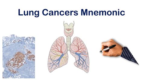 Lung Cancer Types Mnemonic Usmle Step Comlex Nclex Youtube