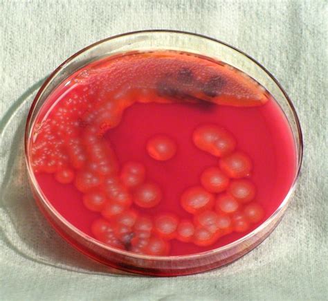 Bacillus Cereus Wikidoc