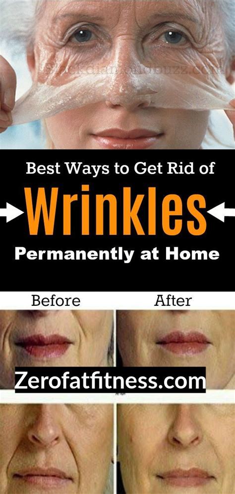 How To Get Rid Of Forehead Wrinkles Fast 10 Best Naturally Remedies