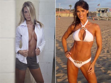Former Playboy Models Get Their Breast Implants Removed Believing They