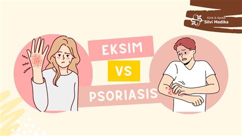 Eksim Vs Psoriasis 6 Perbedaan Yang Perlu Diketahui