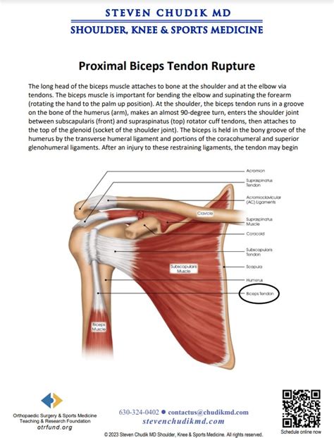 Proximal Biceps Tendon Rupture Steven Chudik Md