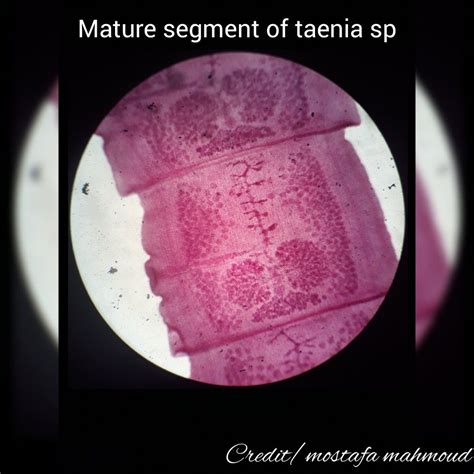 Parasitology Mature Segment Of Taenia Sp Faculty Of Pharmacy MTI