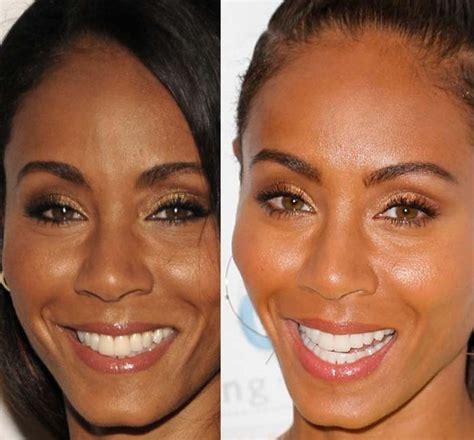 Jada Pinkett Smith Before And After Plastic Surgery 03