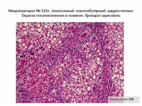 Мускатный фиброз печени микропрепарат описание - фото презентация Картинка - Мускатный фиброз печени микропрепарат описание - фото презентация